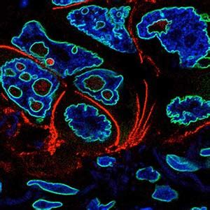 fredhutch|Hatch Lab .